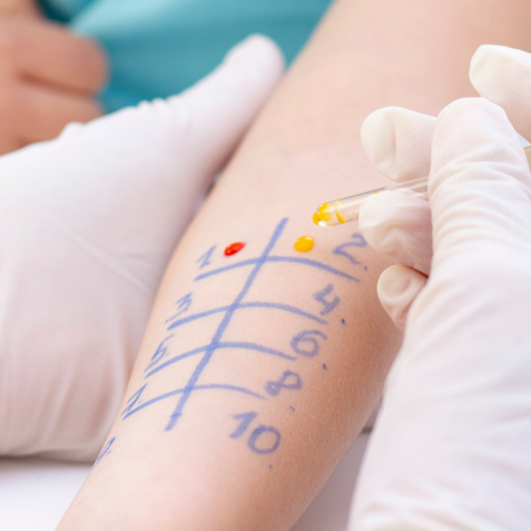 Allergen Immunotherapy (AIT) 1 – Introductory