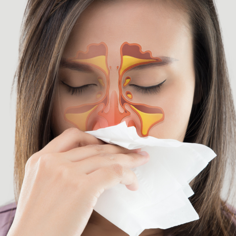 Chronic Rhinosinusitis (CRS) 1 – Introductory